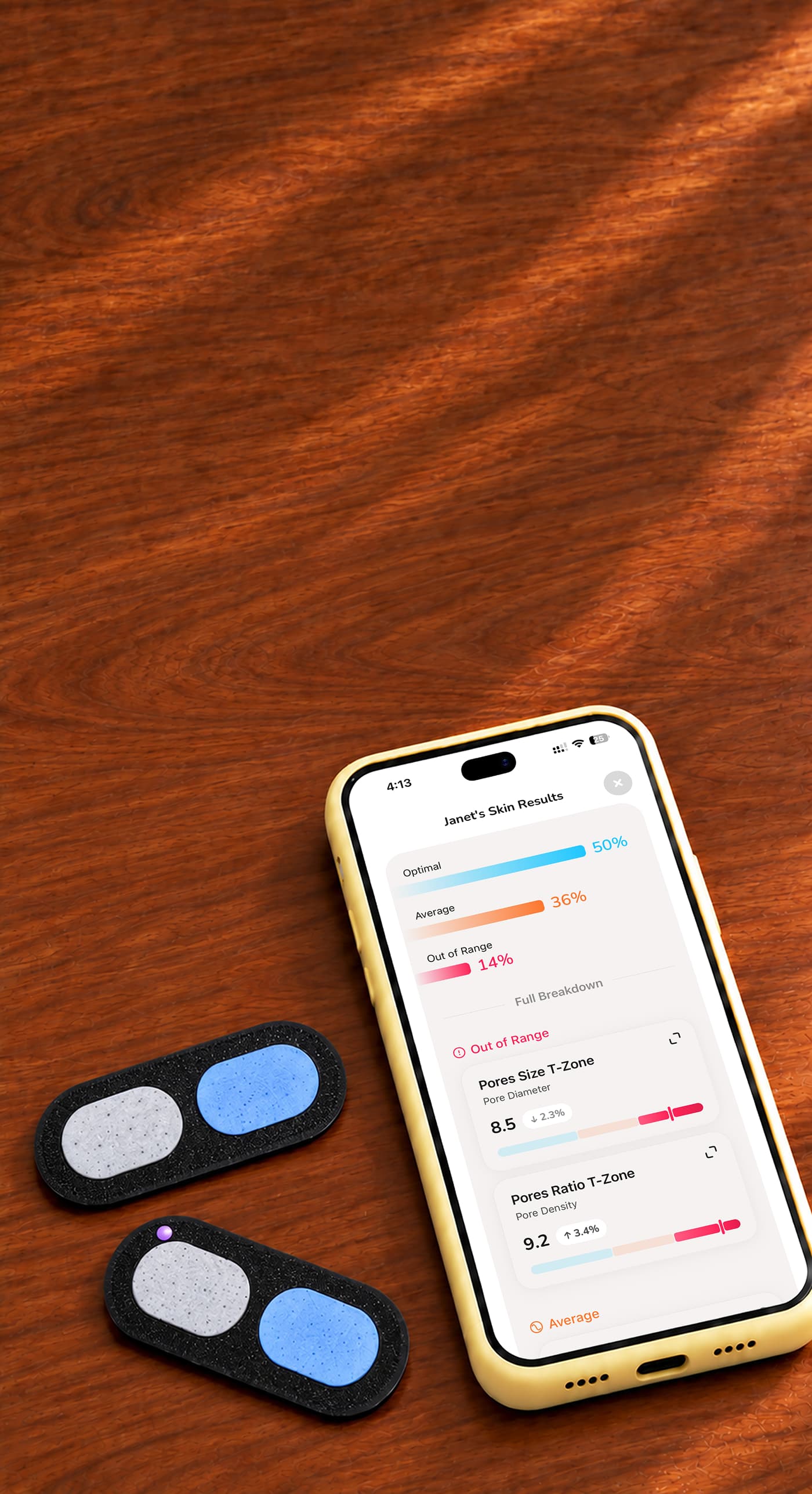 Two used Skinfield Analyzers beside a phone showing skin analysis results, on a wooden table